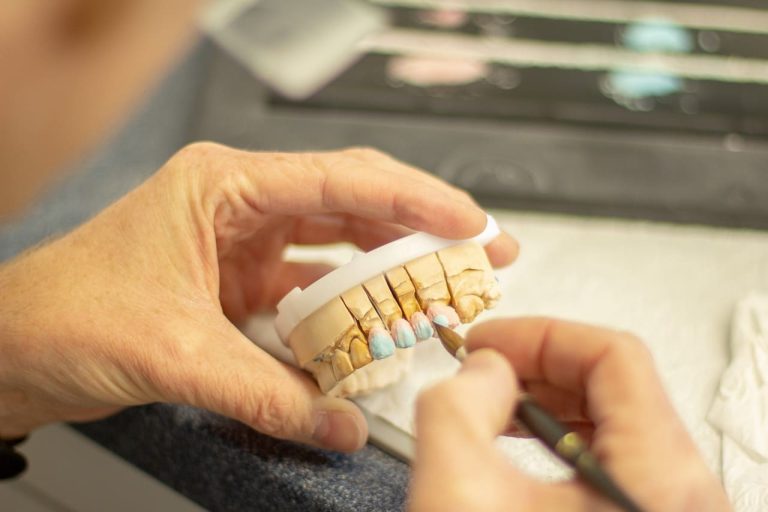 La normalización y aceptación de los implantes dentales